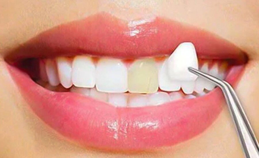 Cosmetic Procedures